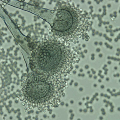 Sachverständiger/Sachkundiger für Schimmel- und Feuchteschäden
